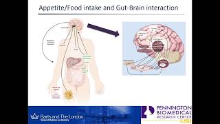 Longterm effects of RouxenY gastric bypass surgery by Madusha Peiris [upl. by Silvio]