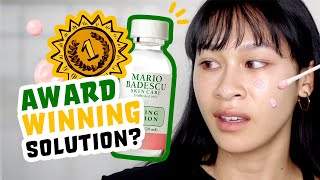 Honest Review 14 days WITH Mario Badescu Drying Lotion [upl. by Adyahs]