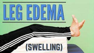 Top 7 Exercises for Leg Edema or Swelling Program or Protocol for Edema [upl. by Tybalt426]