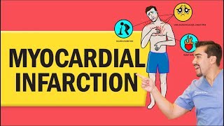 Myocardial Infarction Heart Attack for Nursing amp NCLEX [upl. by Atiuqer]