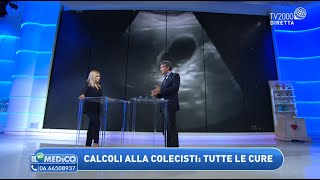 Calcoli alla colecisti ecco cosa fare [upl. by Critta598]