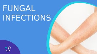 Fungal Infections  Causes Prevention and Cure [upl. by Nibas]