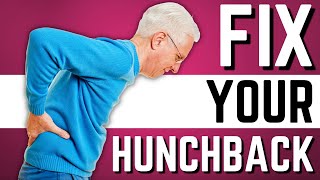 Top 10 Exercises to Stop Hunchback Kyphosis Forward Head Posture [upl. by Latsyrd818]